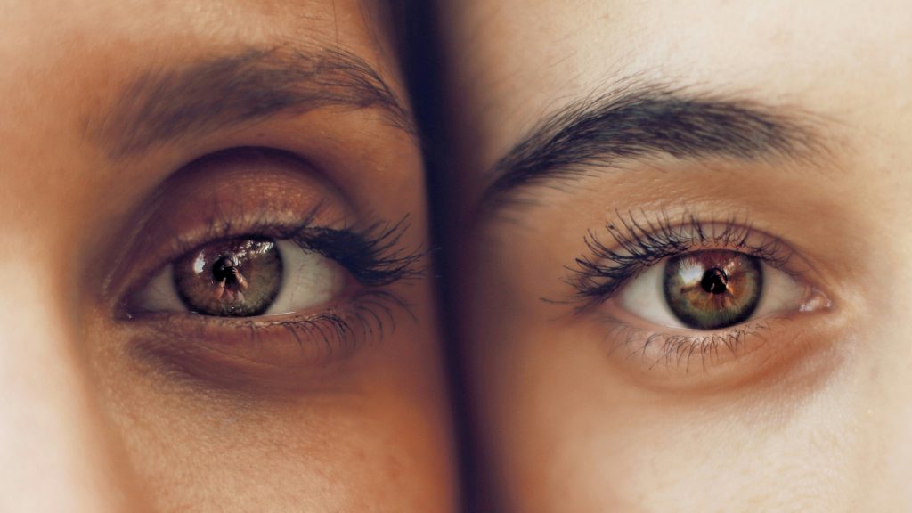 treatment for eye bags
